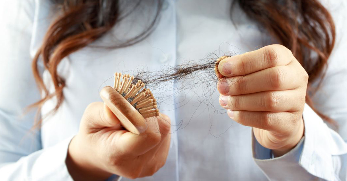 Rednutie vlasov: Genetika zohráva pri hustote vlasov dôležitú úlohu