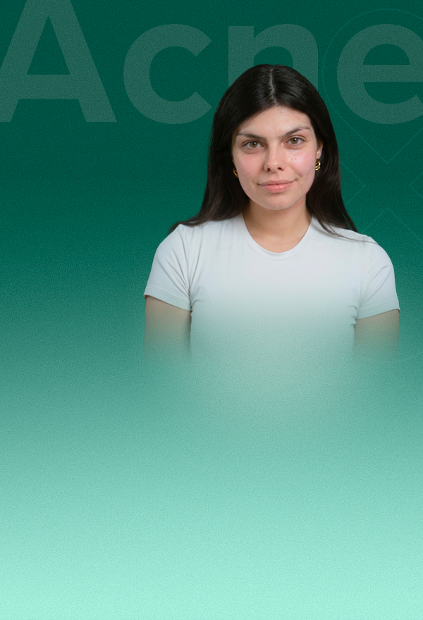 akne_LOBEY