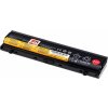 Baterie T6 Power pro Lenovo ThinkPad L560, L570, 5200mAh, 56Wh, 6cell