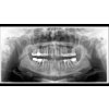 Sirona Orthophos S 2D/3D