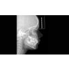Sirona Orthophos S 2D/3D