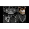 Sirona Orthophos S 2D/3D