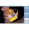 1365 3 3dclassic 3 x 3d cbct proface impression scan