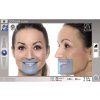 1524 1 planmeca viso gui screendump