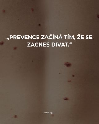Jo. A přesně proto k nám přichází Fotofinder. Protože dělat beauty bez prevence už nám prostě nedává smysl. Chceme...