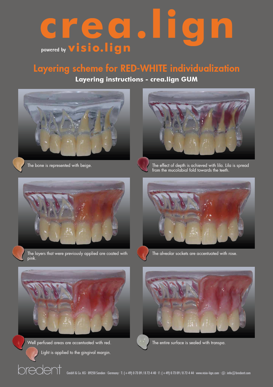 crea.lign Layering scheme for red-white individualization