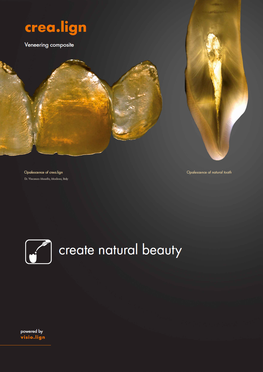 crea.lign Veneering composite