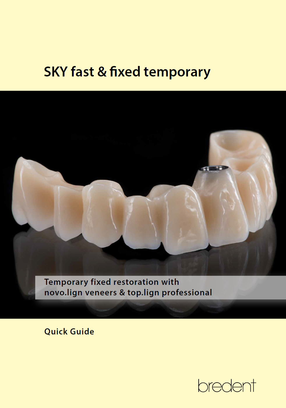 SKY fast & fixed temporary