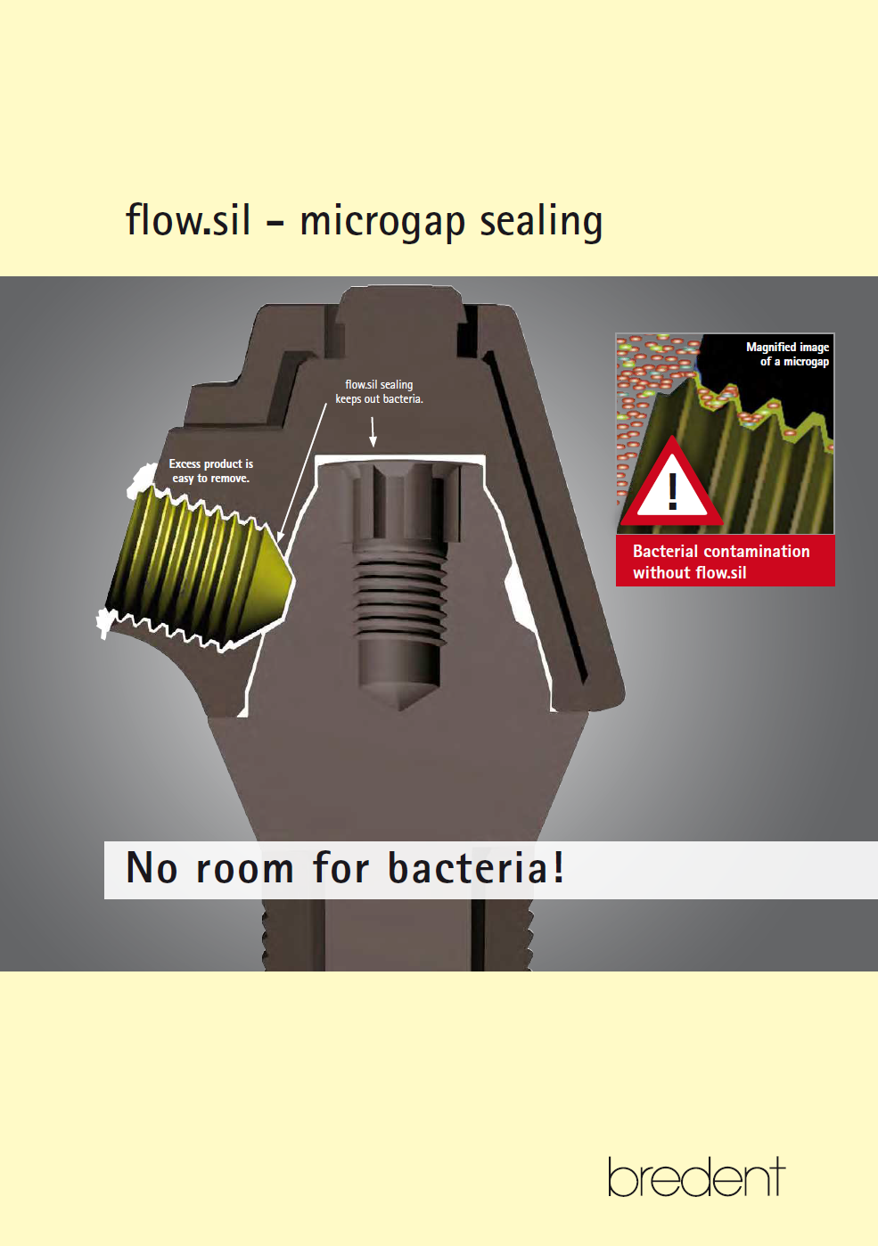 flow.sil microgap sealing