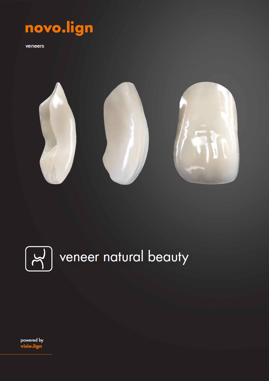 novo.lign Veneers
