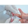 626 2 innova pharma adexus hcg tehotensky krevni test