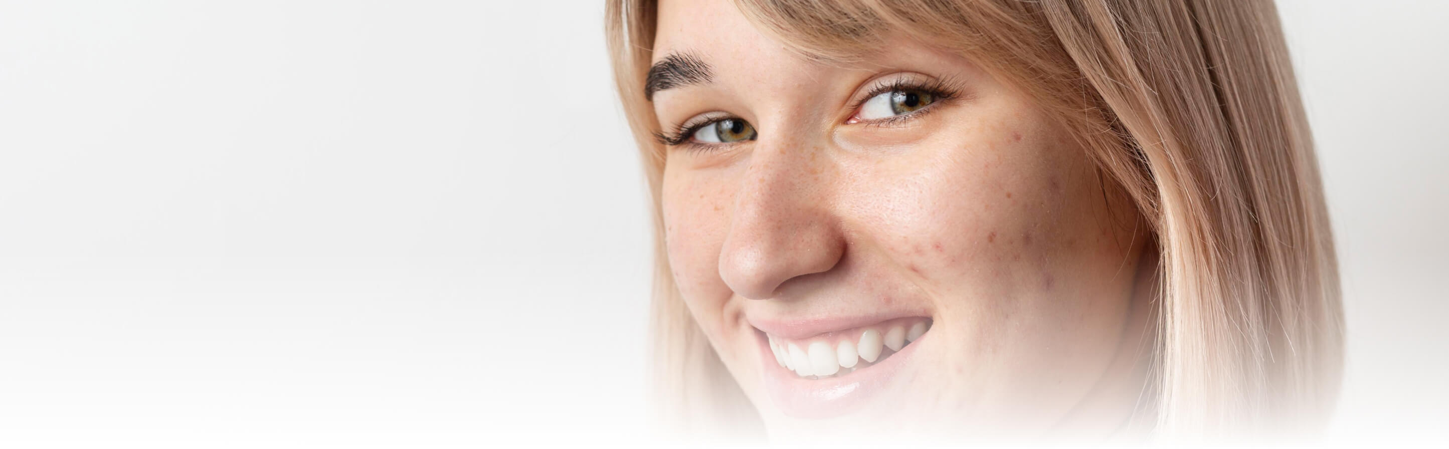 pure-skin-blog-slo-001