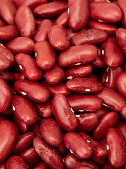 red kidney