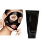 fekete peeling arcmaszk