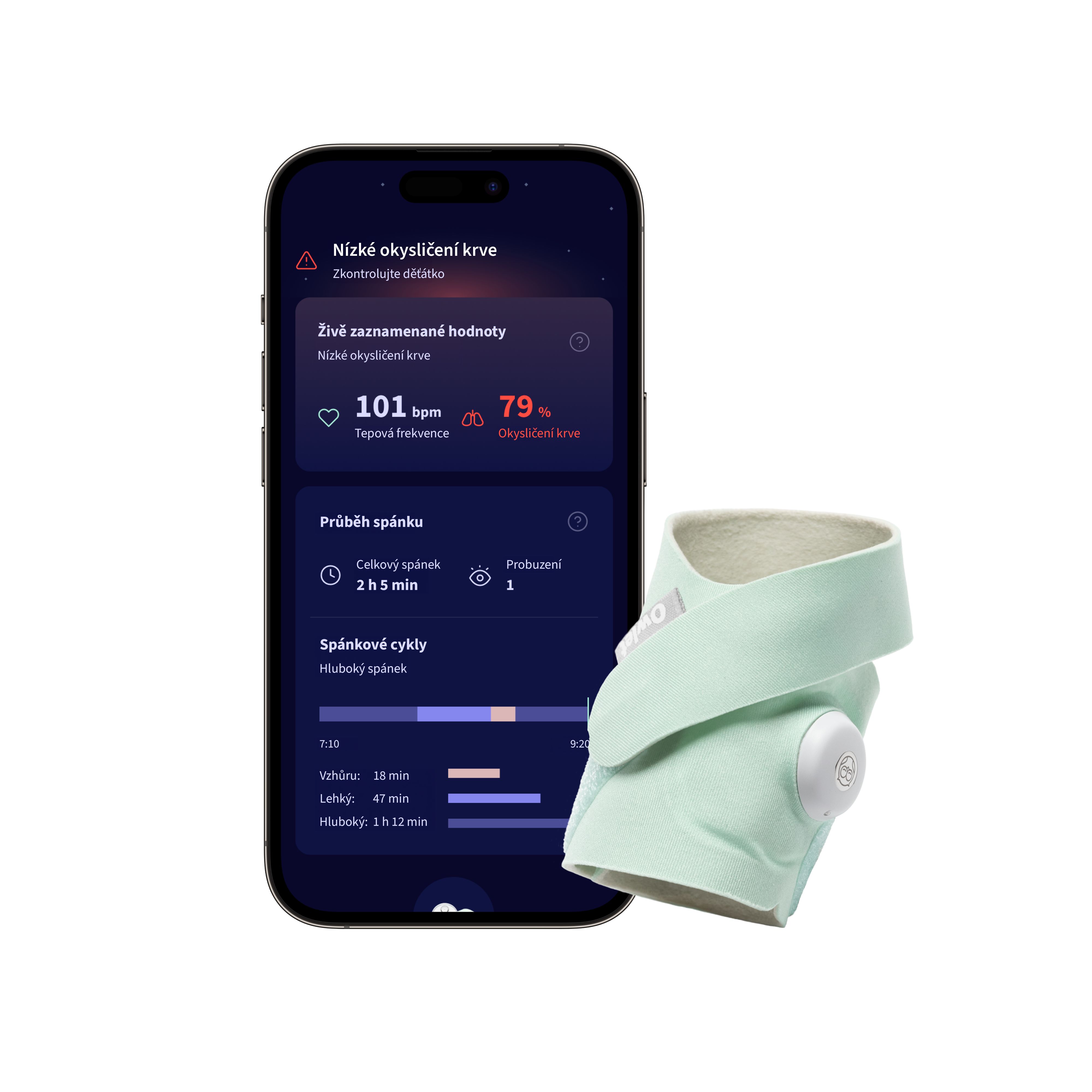 E-shop Owlet Inteligentná ponožka Dream Sock, Mint