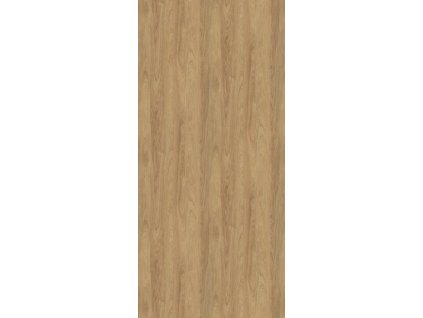 ad141754 67d1 4d11 94cc 9c6229bf9956 lrg