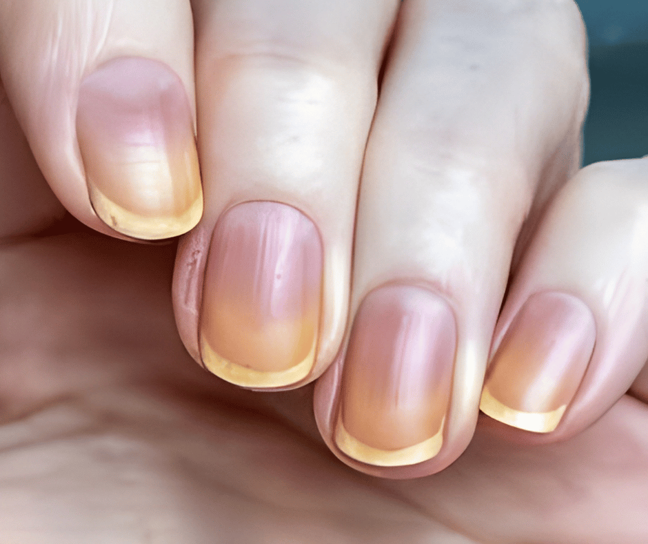 #blog - jak opticky vybělit nehty: tipy pro dokonalý white look bez zažloutnutí