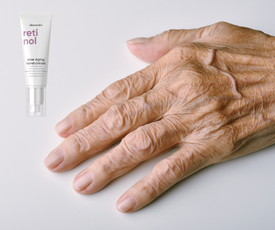 #blog - retinol - gamechanger v boji s pigmentovými skvrnami a stárnutím