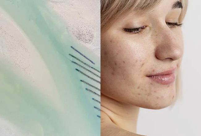 acf-composition-image-025880