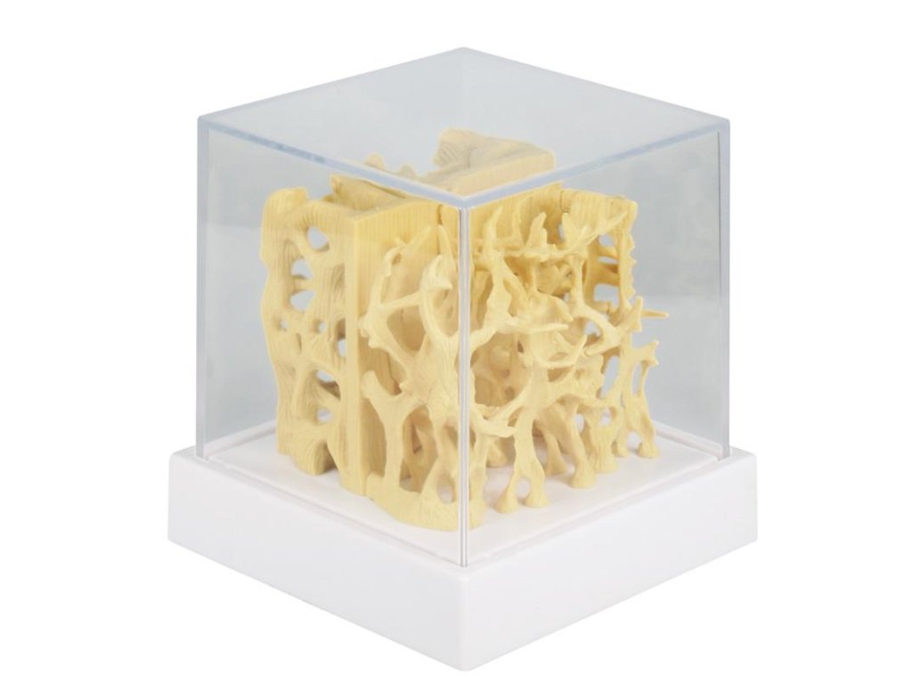 49353 anatomicky model porovnania zdravej a osteoporotickej struktury kosti 4062 i erler zimmer