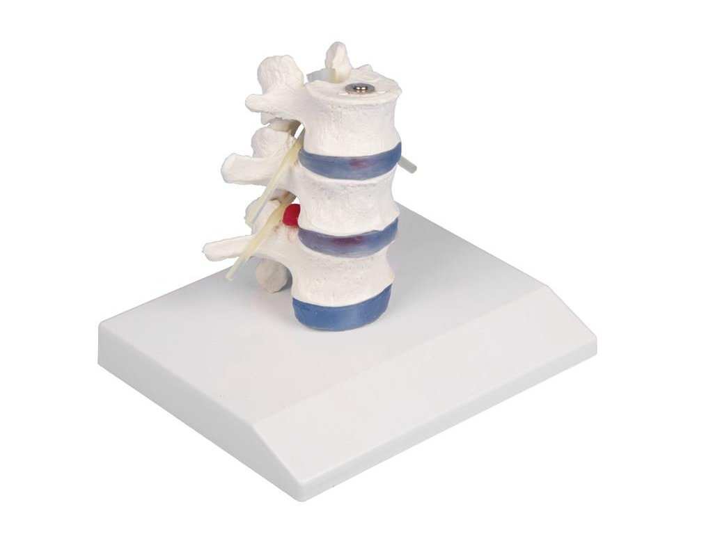 49362 anatomicky model bedrovych stavcov s vysunutymi platnickami 4047 i erler zimmer