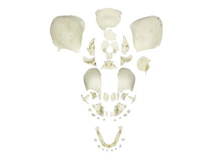 49149 rozlozena ludska fetalna lebka plny termin 4728 i erler zimmer