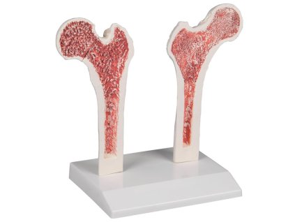 49197 49197 stehenna kost s osteoporozou 4030 i erler zimmer