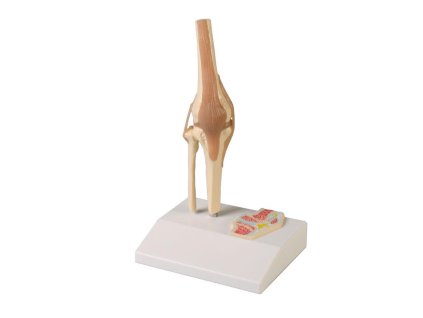 49200 49200 miniaturny kolenny klb s priecnym rezom 4522 i erler zimmer