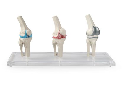 49206 49206 model kolena s implantatom 1125 i erler zimmer