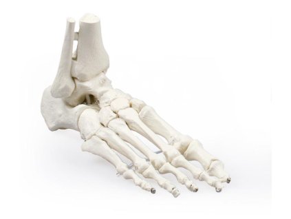 49218 49218 kostra nohy s vlozenou tibio fibulou 6053 i erler zimmer