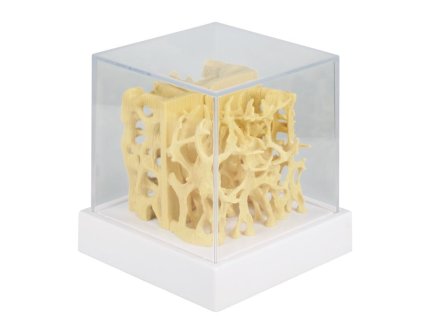 49353 49353 anatomicky model porovnania zdravej a osteoporotickej struktury kosti 4062 i erler zimmer