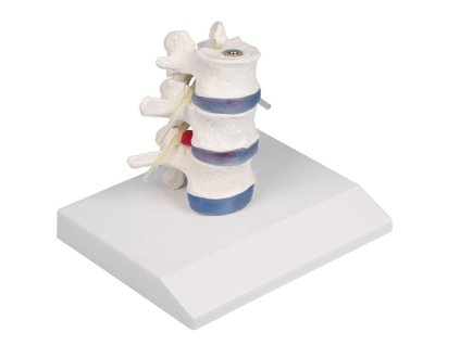 49362 anatomicky model bedrovych stavcov s vysunutymi platnickami 4047 i erler zimmer