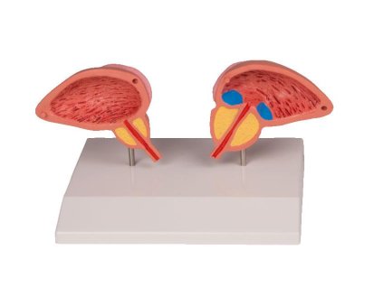 49512 anatomicky model prostaty 2 diely 1261 i erler zimmer