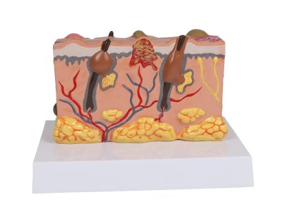 49578 49578 pathologisches hautmodell 1