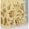 49353 3 49353 3 anatomicky model porovnania zdravej a osteoporotickej struktury kosti 4062 i erler zimmer