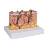 49578 1 pathologisches hautmodell 1 1