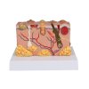 49578 2 pathologisches hautmodell 2