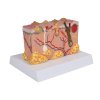 49578 3 pathologisches hautmodell 3