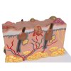 49578 4 49578 4 pathologisches hautmodell 4