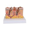 49578 49578 pathologisches hautmodell 1