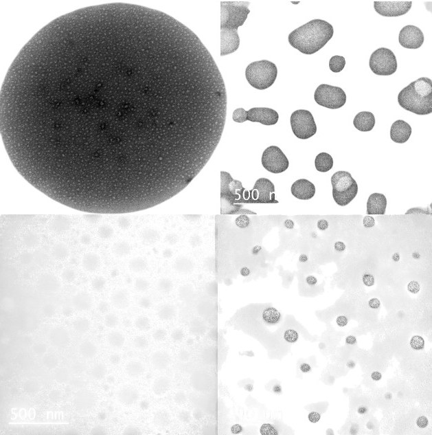 Lipozómy – transmisná elektrónová mikroskopia (TEM)