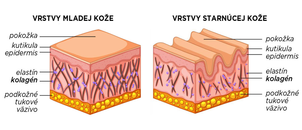 obr-koza