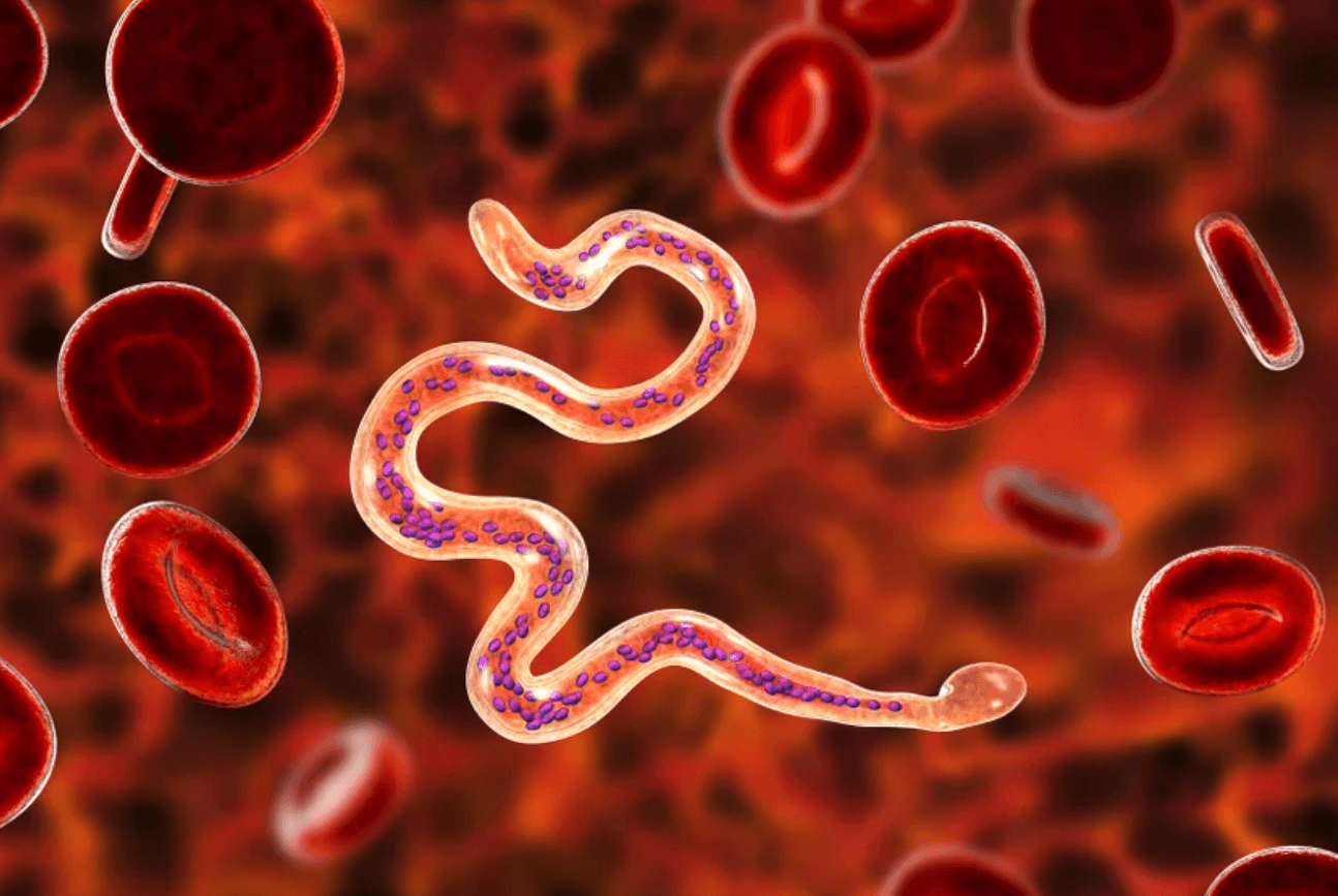 Domáci test na parazity. Ako zistiť, či máte v tele neviditeľných nepriateľov?