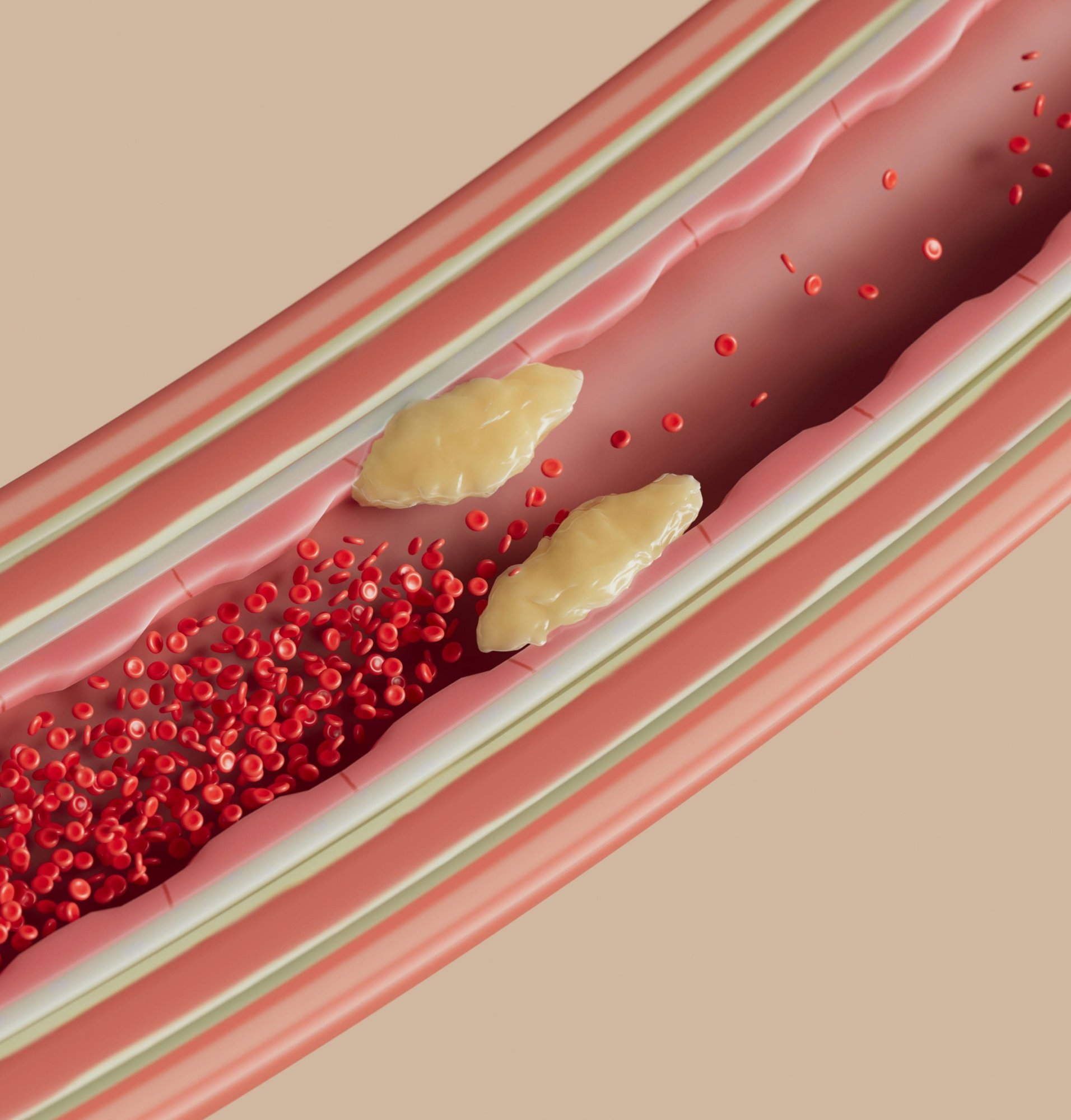 Aké sú správne hodnoty cholesterolu a ako ich prirodzene udržať v norme?