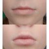 GESKE Lip Volumizer & Booster 6v1 magenta_9