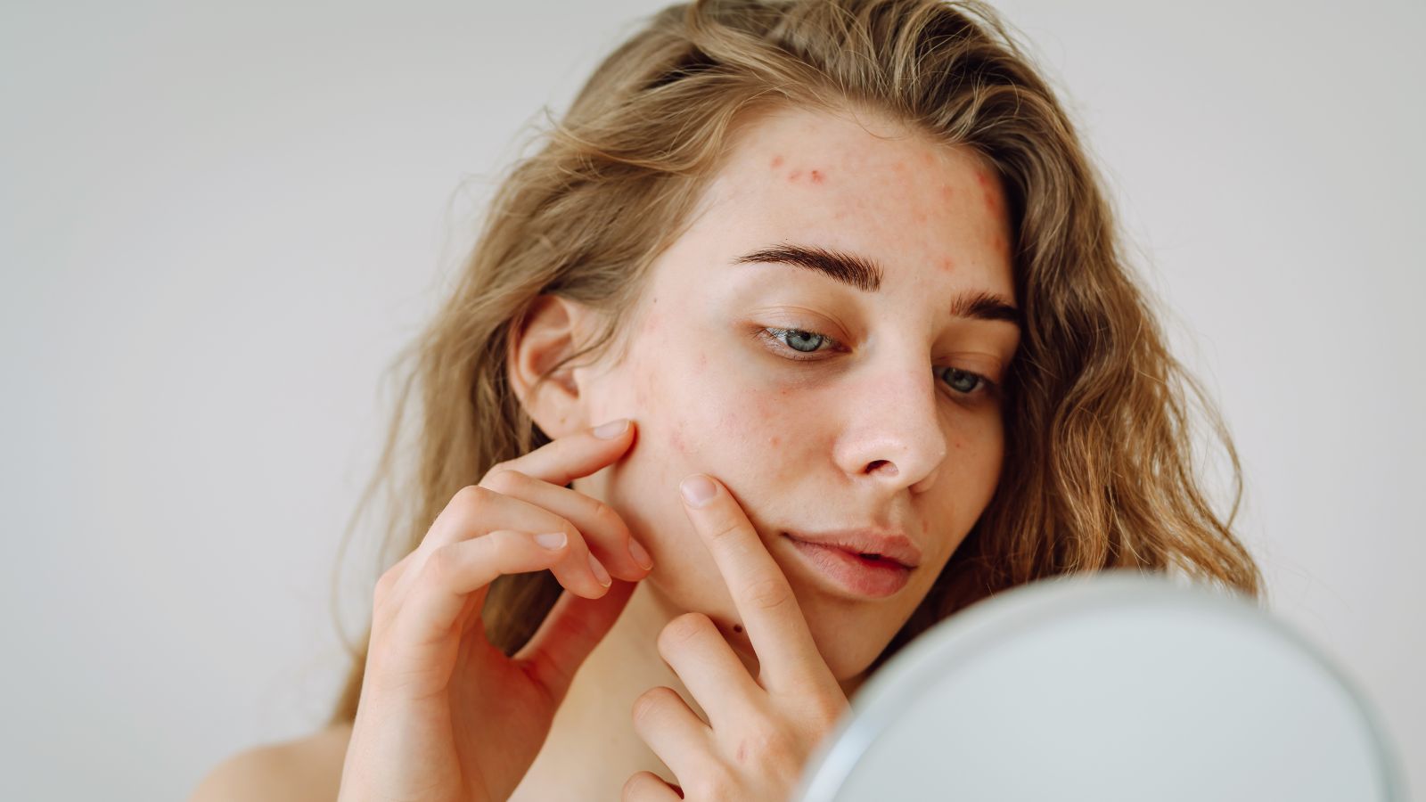 Jak zkrotit lesk a vyzrát nad mastnou pletí?