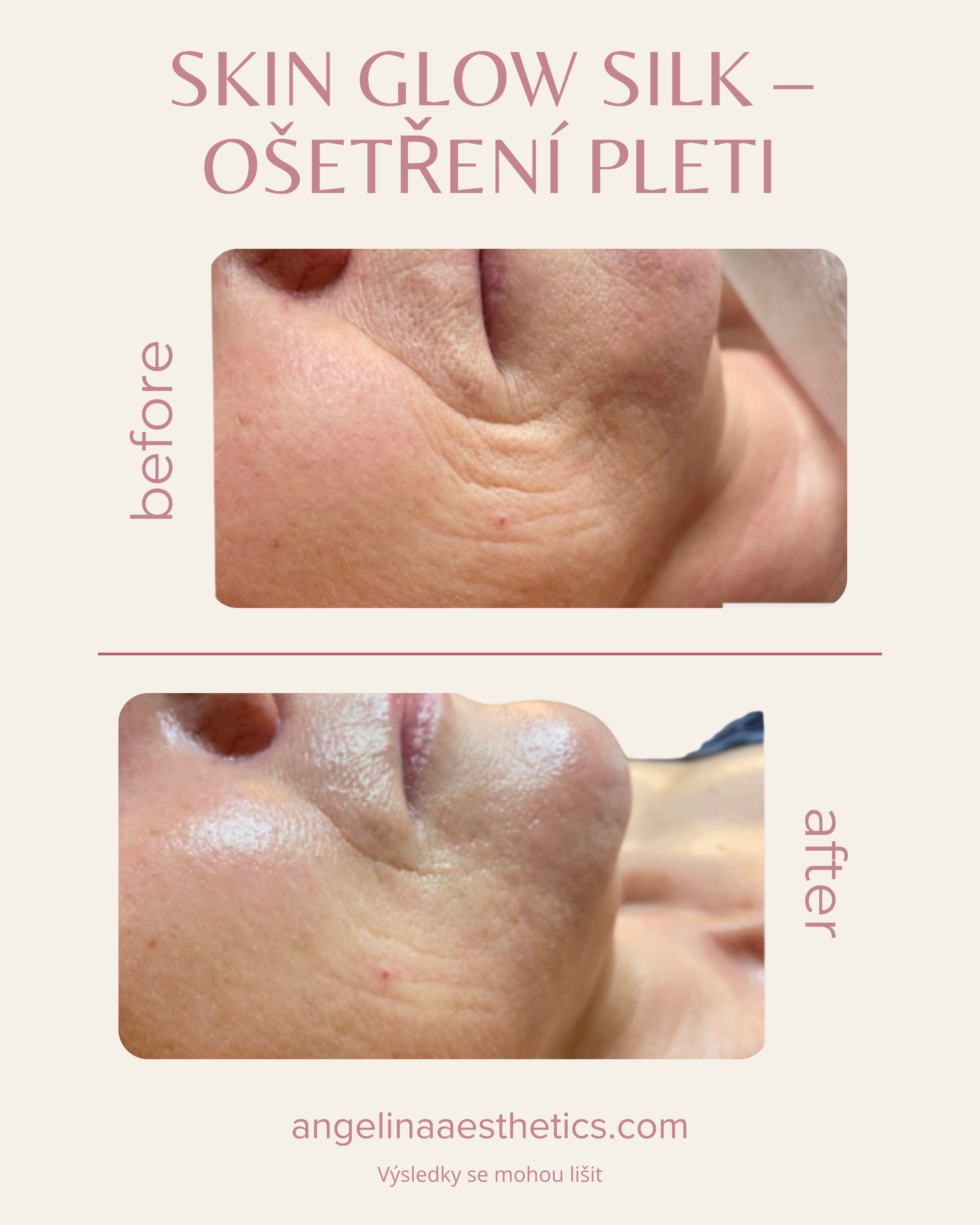 Skin Glow Silk — před a po