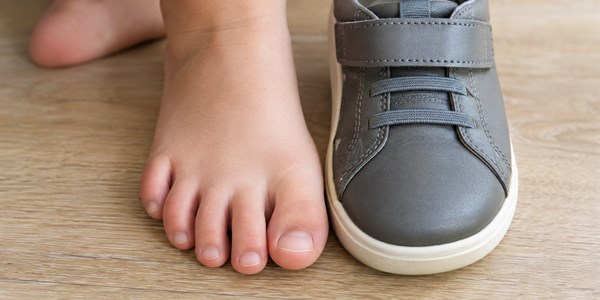 Zarastajúci necht u dieťaťa: môže k problému prispievať obuv?
