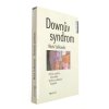Downův syndrom