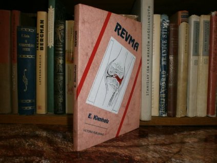 Revma